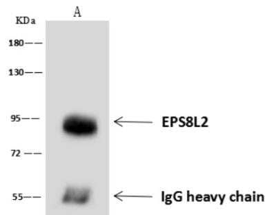 Immunoprecipitation: EPS8L2 Antibody [NBP3-06508]