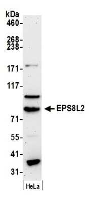 Western Blot: EPS8L2 Antibody [NB100-97850]