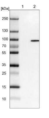 Western Blot: EPS8L2 Antibody [NBP1-83613]