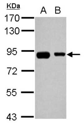 Western Blot: EPS8L2 Antibody [NBP2-16357]