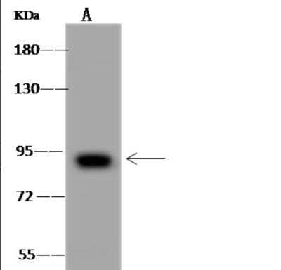 Western Blot: EPS8L2 Antibody [NBP3-06508]