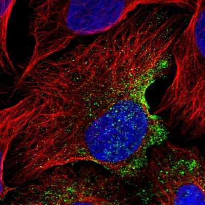 Immunocytochemistry/ Immunofluorescence: EPS8L3 Antibody [NBP2-13966]