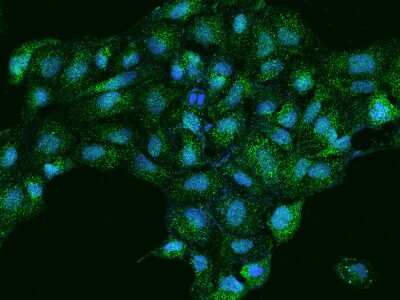 Immunocytochemistry/ Immunofluorescence: EPS8L3 Antibody [NBP2-98054]