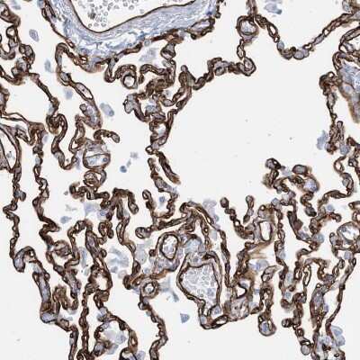 Immunohistochemistry-Paraffin: EPS8L3 Antibody [NBP2-13966]