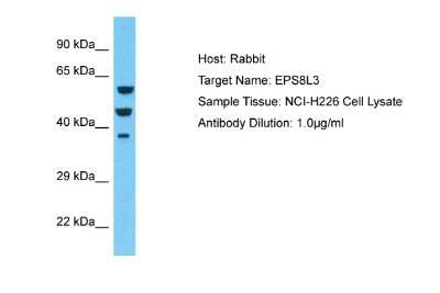 Western Blot: EPS8L3 Antibody [NBP2-83010]