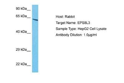 Western Blot: EPS8L3 Antibody [NBP2-83011]