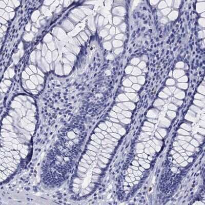 Immunohistochemistry-Paraffin: EPX Antibody [NBP3-17016]