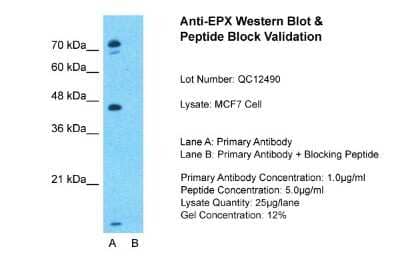 Western Blot: EPX Antibody [NBP1-58010]