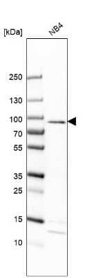 Western Blot: EPX Antibody [NBP2-13967]