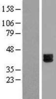 Western Blot: DSPG3/EPYC Overexpression Lysate [NBL1-10307]