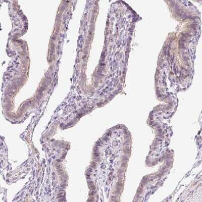 Immunohistochemistry-Paraffin: ER Membrane Protein Complex Subunit 10 Antibody [NBP2-30611]