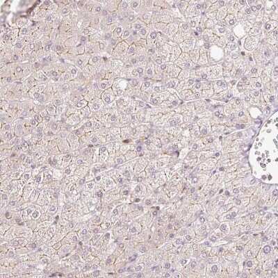 Immunohistochemistry-Paraffin: ER Membrane Protein Complex Subunit 10 Antibody [NBP2-30611]