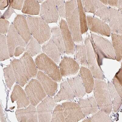 Immunohistochemistry-Paraffin: ER Membrane Protein Complex Subunit 10 Antibody [NBP2-30611]