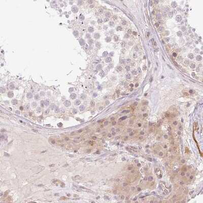 Immunohistochemistry-Paraffin: ER Membrane Protein Complex Subunit 10 Antibody [NBP2-30611]