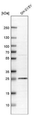 Western Blot: ER Membrane Protein Complex Subunit 10 Antibody [NBP2-30611]