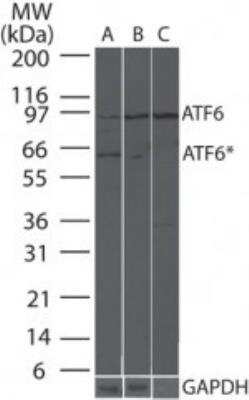 Western Blot: ER Stress / UPR Antibody Pack [NBP2-52746]