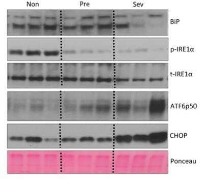 Western Blot: ER Stress / UPR Antibody Pack [NBP2-52746]