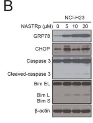 Western Blot: ER Stress / UPR Antibody Pack [NBP2-52746]