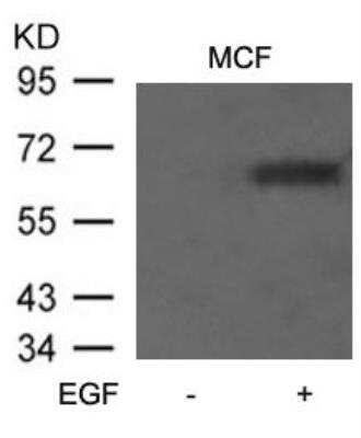 Western Blot: ER alpha/NR3A1 [p Ser106] Antibody [NB100-81912]