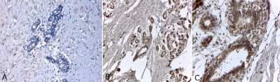 Immunohistochemistry-Frozen: ER alpha/NR3A1 Antibody (33) [NB300-560]
