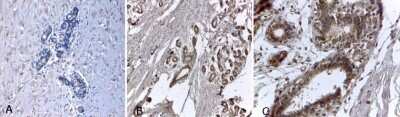 Immunohistochemistry-Paraffin: ER alpha/NR3A1 Antibody (33) [NB300-560]
