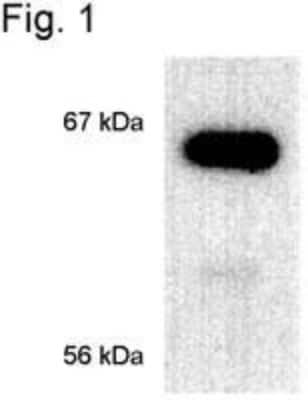 Western Blot: ER alpha/NR3A1 Antibody (33) [NB300-560]