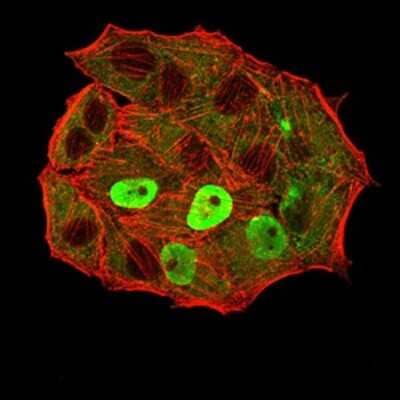 Immunocytochemistry/ Immunofluorescence: ER alpha/NR3A1 Antibody (6A6E8) - BSA Free [NBP2-61764]