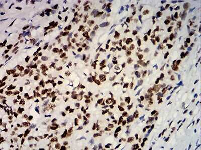 Immunohistochemistry-Paraffin: ER alpha/NR3A1 Antibody (6A6E8) - BSA Free [NBP2-61764]