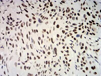 Immunohistochemistry-Paraffin: ER alpha/NR3A1 Antibody (6A6E8) - BSA Free [NBP2-61764]