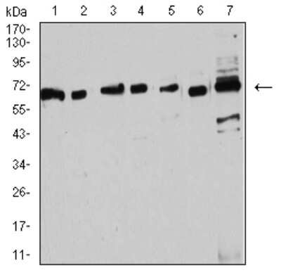 Western Blot: ER alpha/NR3A1 Antibody (6A6E8)BSA Free [NBP2-61764]