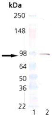 Western Blot: ER alpha/NR3A1 Antibody (C-542) [NBP1-19318]