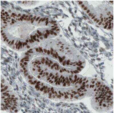 Immunohistochemistry: ER alpha/NR3A1 Antibody (CL1196) [NBP2-34478]