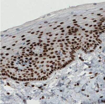 Immunohistochemistry: ER alpha/NR3A1 Antibody (CL1196) [NBP2-34478]