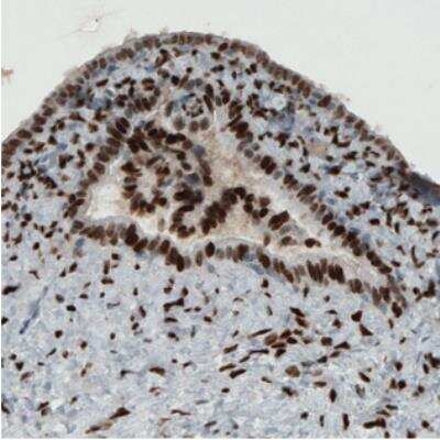 Immunohistochemistry: ER alpha/NR3A1 Antibody (CL1196) [NBP2-34478]