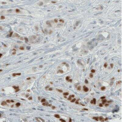 Immunohistochemistry: ER alpha/NR3A1 Antibody (CL1196) [NBP2-34478]
