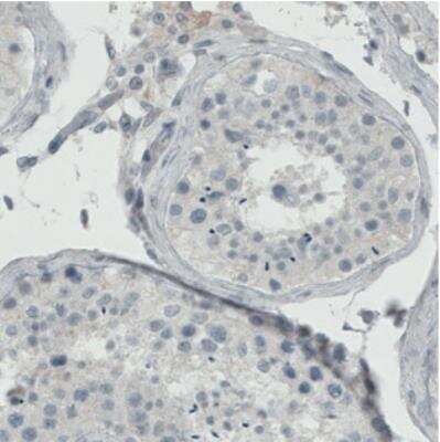 Immunohistochemistry: ER alpha/NR3A1 Antibody (CL1196) [NBP2-34478]