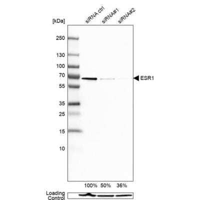 Western Blot: ER alpha/NR3A1 Antibody (CL1196) [NBP2-34478]