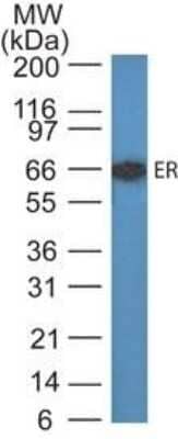 Western Blot: ER alpha/NR3A1 Antibody (ER505)Azide and BSA Free [NBP2-33106]