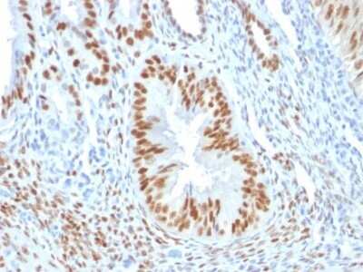 Immunohistochemistry-Paraffin: ER alpha/NR3A1 Antibody (ER506) - Azide and BSA Free [NBP2-33321]