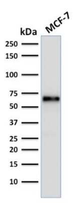 Western Blot: ER alpha/NR3A1 Antibody (ER506) [NBP2-33320]