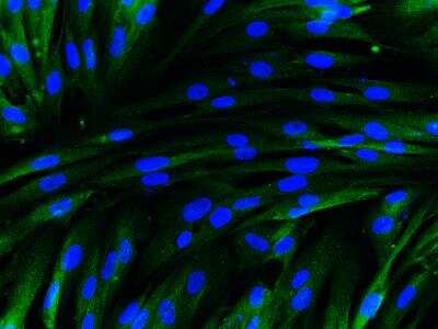 Immunocytochemistry/ Immunofluorescence: ER alpha/NR3A1 Antibody [NB100-81909]