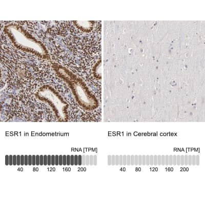 Immunohistochemistry-Paraffin: ER alpha/NR3A1 Antibody [NBP1-84826]