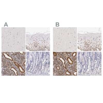 Immunohistochemistry-Paraffin: ER alpha/NR3A1 Antibody [NBP1-84826]