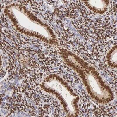 Immunohistochemistry-Paraffin: ER alpha/NR3A1 Antibody [NBP1-84826]