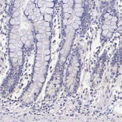 Immunohistochemistry-Paraffin: ER alpha/NR3A1 Antibody [NBP1-84826]