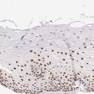 Immunohistochemistry-Paraffin: ER alpha/NR3A1 Antibody [NBP1-84826]