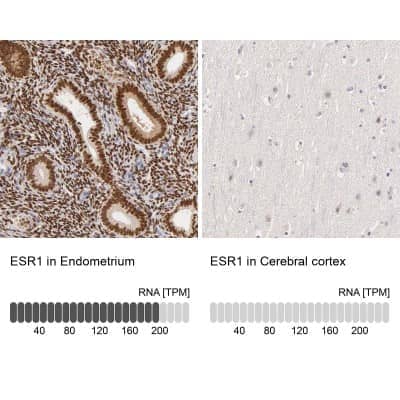 Immunohistochemistry-Paraffin: ER alpha/NR3A1 Antibody [NBP1-84827]