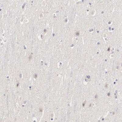 Immunohistochemistry-Paraffin: ER alpha/NR3A1 Antibody [NBP1-84827]
