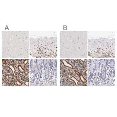 Immunohistochemistry-Paraffin: ER alpha/NR3A1 Antibody [NBP1-84827]