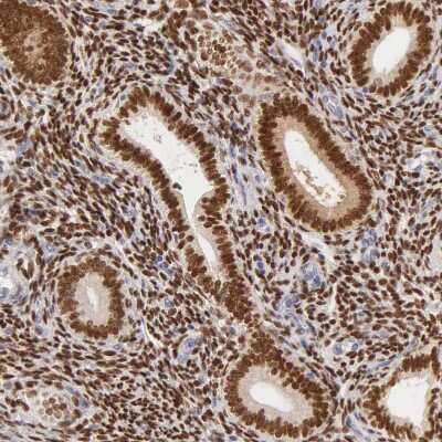 Immunohistochemistry-Paraffin: ER alpha/NR3A1 Antibody [NBP1-84827]